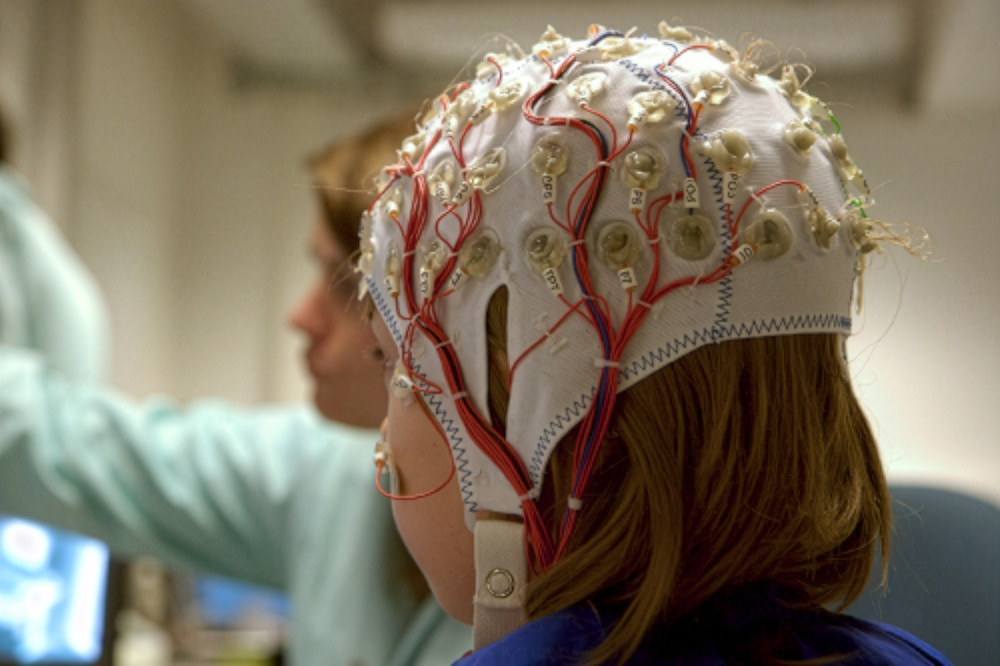 Patiënt met EEG-kap tijdens onderzoek naar epilepsie